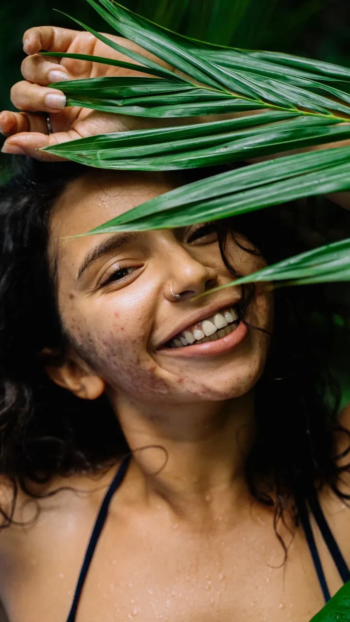 Portrait before AI skin retouching, with acne and redness on the cheek